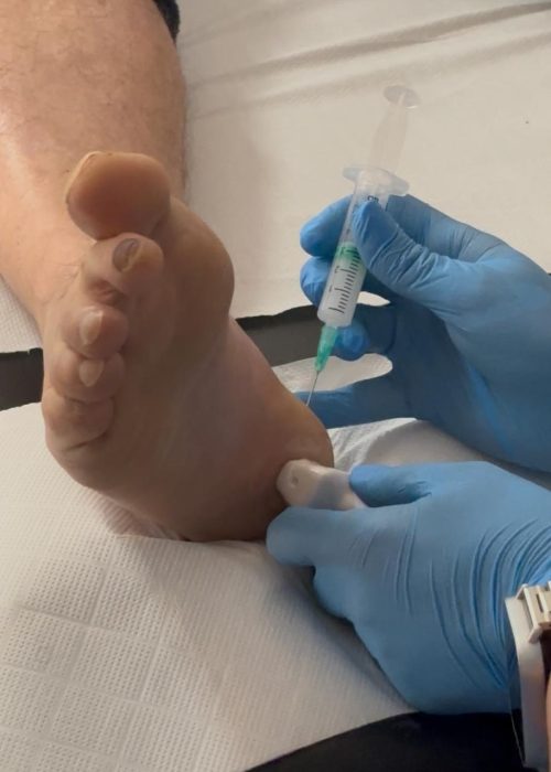 INFILTRACIONECOGUIADA1763724507